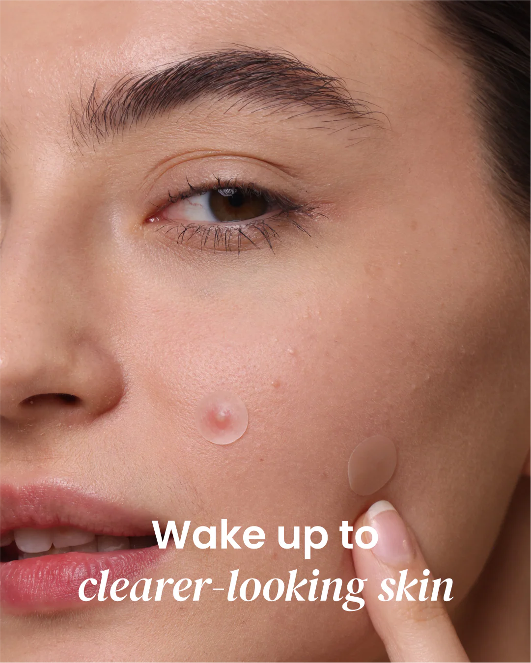 Overnight Pimple Patch - Image 4